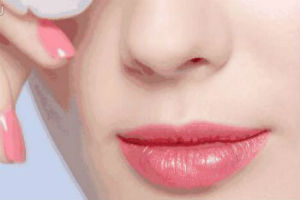宁波“玻尿酸丰唇”打造效果美感唇